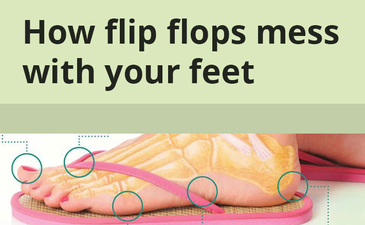 How Flip Flops Mess With Your Feet